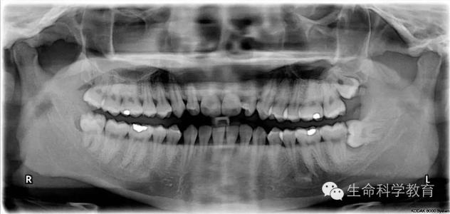 如何改变性格缺陷 【身体上的很多小缺陷可以改变】