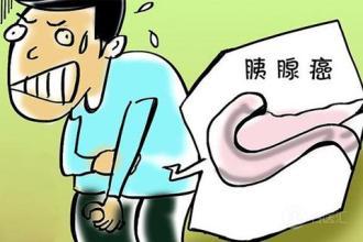 胰腺癌晚期能活多久 胰腺癌