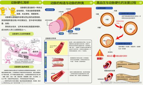 动脉硬化检测的意义 动脉硬化检测 动脉硬化的九大检测方法