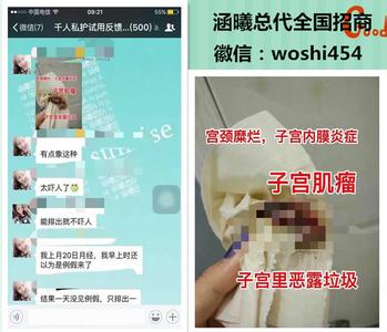 霉菌性阴炎怎么能治好 霉菌性阴道炎怎么治疗最好