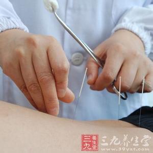 中医针灸治疗中风 针灸的功能 中医针灸治疗中风