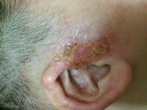 十大错误害惨宝宝