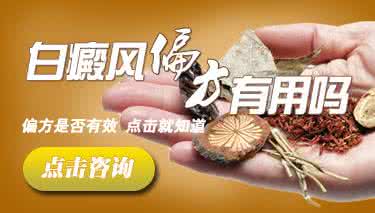 白癲风最有效治疗偏方 治疗白癜风的偏方