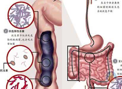 慢性肠炎病因 慢性肠炎有哪些病因？