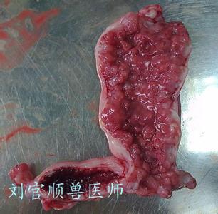 子宫内膜厚增生 子宫内膜厚有什么症状 子宫内膜增生有哪些症状