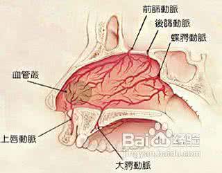 流鼻血 中医 中医解析流鼻血的原因