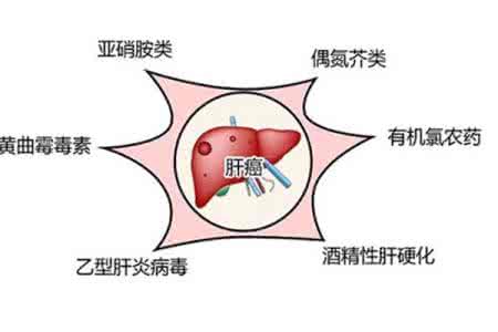 肝癌高发区 专家详解肝癌高发的原因