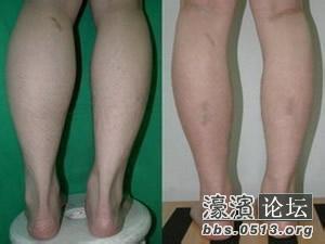 快速让萝卜腿变成细腿 如何快速消灭萝卜腿