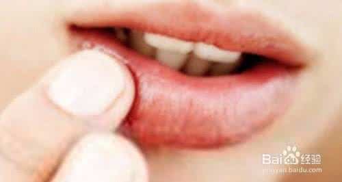 嘴唇干裂起皮 嘴唇干裂起皮 嘴唇干裂是什么原因?嘴唇干裂起皮怎么办