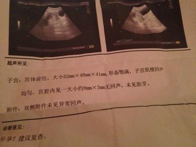 孕囊椭圆形是男孩女孩 孕囊不圆是怎么回事?如何预防孕囊问题