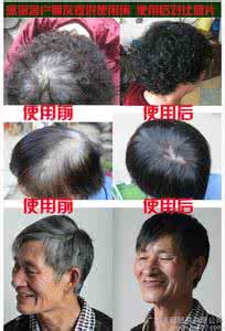 不伤头发的染发剂 天然的染发剂---不想伤头发可以试一试