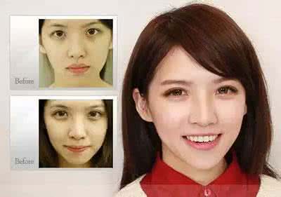 霍汶希双胞胎妹妹 霍汶希双胞胎妹妹 全切双眼皮9个月 和双胞胎妹妹对比照