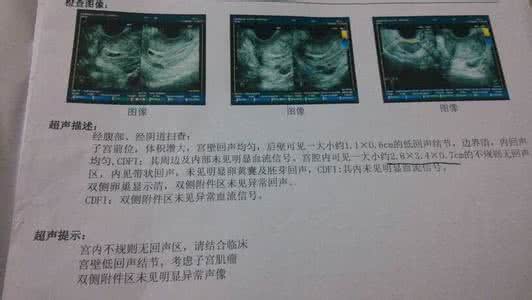 清宫手术注意事项 清宫手术后注意事项 做完清宫手术 清宫手术后护理事项