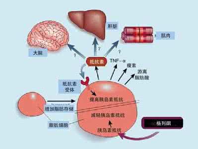 胰岛素抵抗的症状 胰岛素抵抗的原因 胰岛素抵抗的症状与治疗