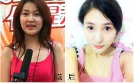 郭美美整容前照片对比 郭美美整容 郭美美的干爹是谁？整容前后对比图