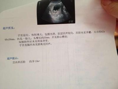 孕囊大小推算受孕时间 根据孕囊怎样推算孕周？孕11周孕囊消失