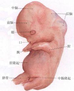 肛门瘙痒发红 新生儿肛门处发红 新生儿无肛门怎么治疗？