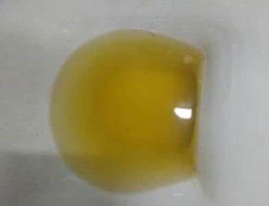 小便好黄怎么回事 小便很黄是怎么回事