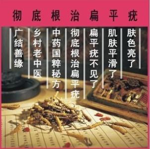 祖传秘方根治前列腺 祖传秘方：扁平疣单方根治永无忧