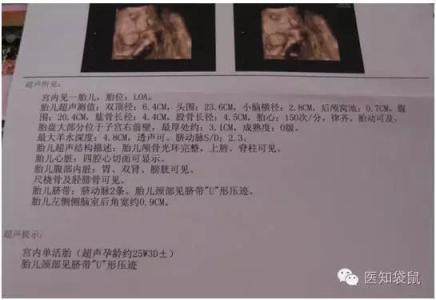 大排畸后还有什么检查 大排畸检查方式有哪些