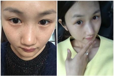 60岁大妈嫁25岁小伙子 45岁大妈爱上25岁小伙 洋葱加“一宝”祛斑美白，9天45岁大妈秀雪嫩肌肤
