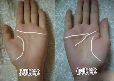 手掌透明凸起小疙瘩 手掌这处凸起竟是天生土豪命