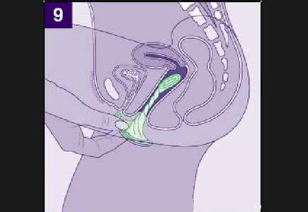 微信和短信哪个更安全 更安全的女用避孕套问世