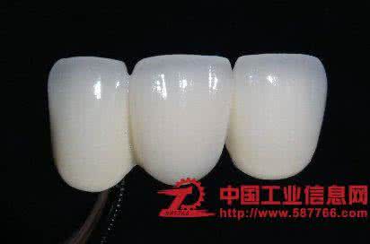 纯钛烤瓷牙的价格 普通烤瓷牙 纯钛烤瓷牙的价格