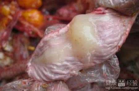 支原体感染的治疗方法 支原体感染的治疗方法 这样治疗效果好