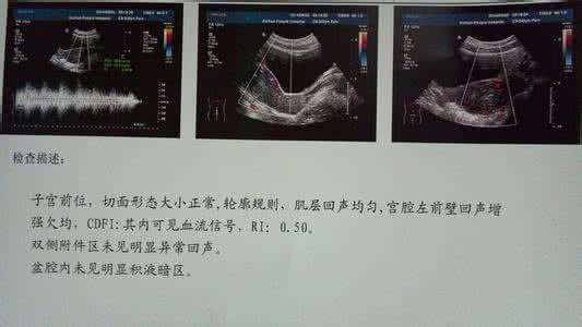 确保安全生产 B超检查确保你的人流安全：人流前做B超检查的重要性