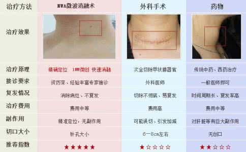 微波治疗前列腺痛 不是所有甲状腺结节都适用微波治疗