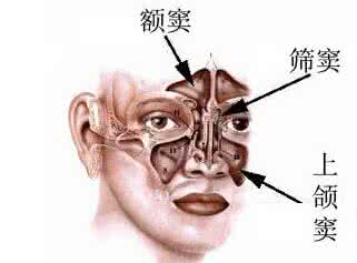 额窦炎治疗 治疗额窦炎经验方