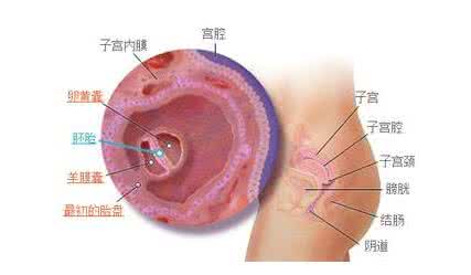 孕囊不发育的原因 孕囊不发育的原因？与内分泌失调有关