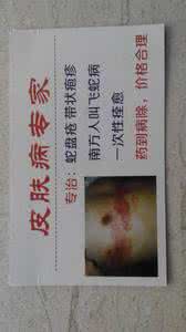 牙膏可以代替硼砂水吗 祖传秘方:肉瘤根治神效验方硼砂膏