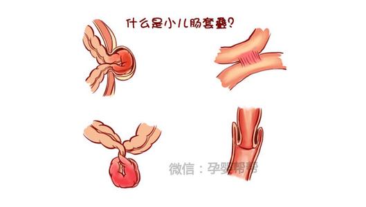 一岁宝宝肠炎多久会好 一岁宝宝肠炎的症状