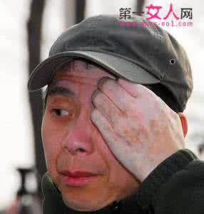 根治糖尿病不复发秘方 秘方：根治白癜风简单得很！