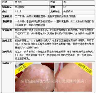 治疗腋臭需要多少费用 治疗腋臭需要多少费用 治疗白癜风的费用需要多少