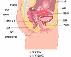 子宫发育不良的原因 子宫发育不良 子宫发育不良有什么危害