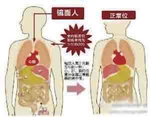 左撇子是天生的吗 左撇子为啥比正常人活得短