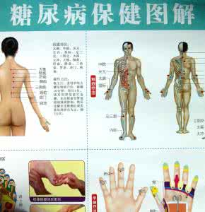 糖尿病防治指南 选穴按摩　防治糖尿病