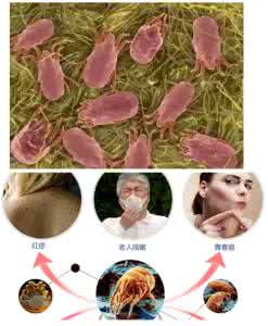 棉被如何清除螨虫 彻底干掉你棉被上几百万螨虫方法,简单有用!!!