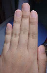 指甲的颜色与健康 健康的指甲颜色：从指甲颜色看健康