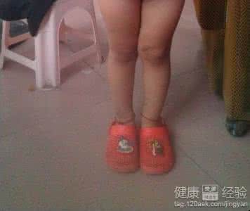 儿童膝关节疼痛 儿童膝关节疼痛 儿童膝关节痛是怎么了?