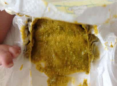 吃奶粉宝宝大便正常图 喝奶粉正常便便图片 喝奶粉的宝宝大便是怎样的