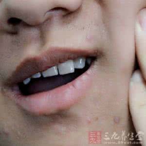 牙周炎症状 牙周炎症状 7个要领护牙防癌