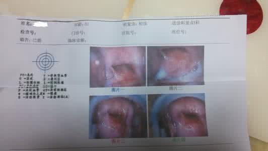 白带发黄的治疗方法 白带发黄是什么原因 治疗白带发黄的方法