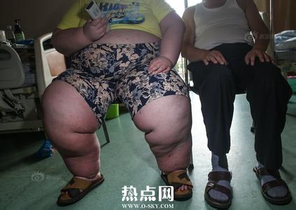 徐周磊减肥后照片 徐周磊 手术减肥