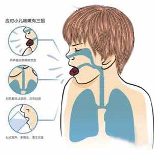 化痰止咳药 止咳药睡前服用 易致痰液堵塞气道呼吸困难