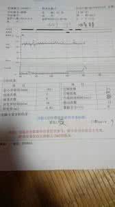 宫缩间隔是怎么计算的 怎么计算宫缩时间