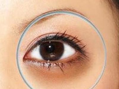 黑眼圈是怎么形成的 怎么去黑眼圈 怎么有效去黑眼圈 黑眼圈是怎么形成的